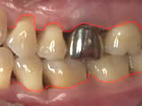 歯茎の位置