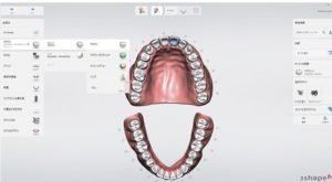 デジタル撮影口腔内　パソコン画面での確認　登戸歯科