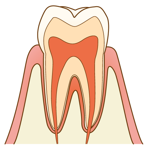 健康な歯　歯の断面図　歯科治療説明