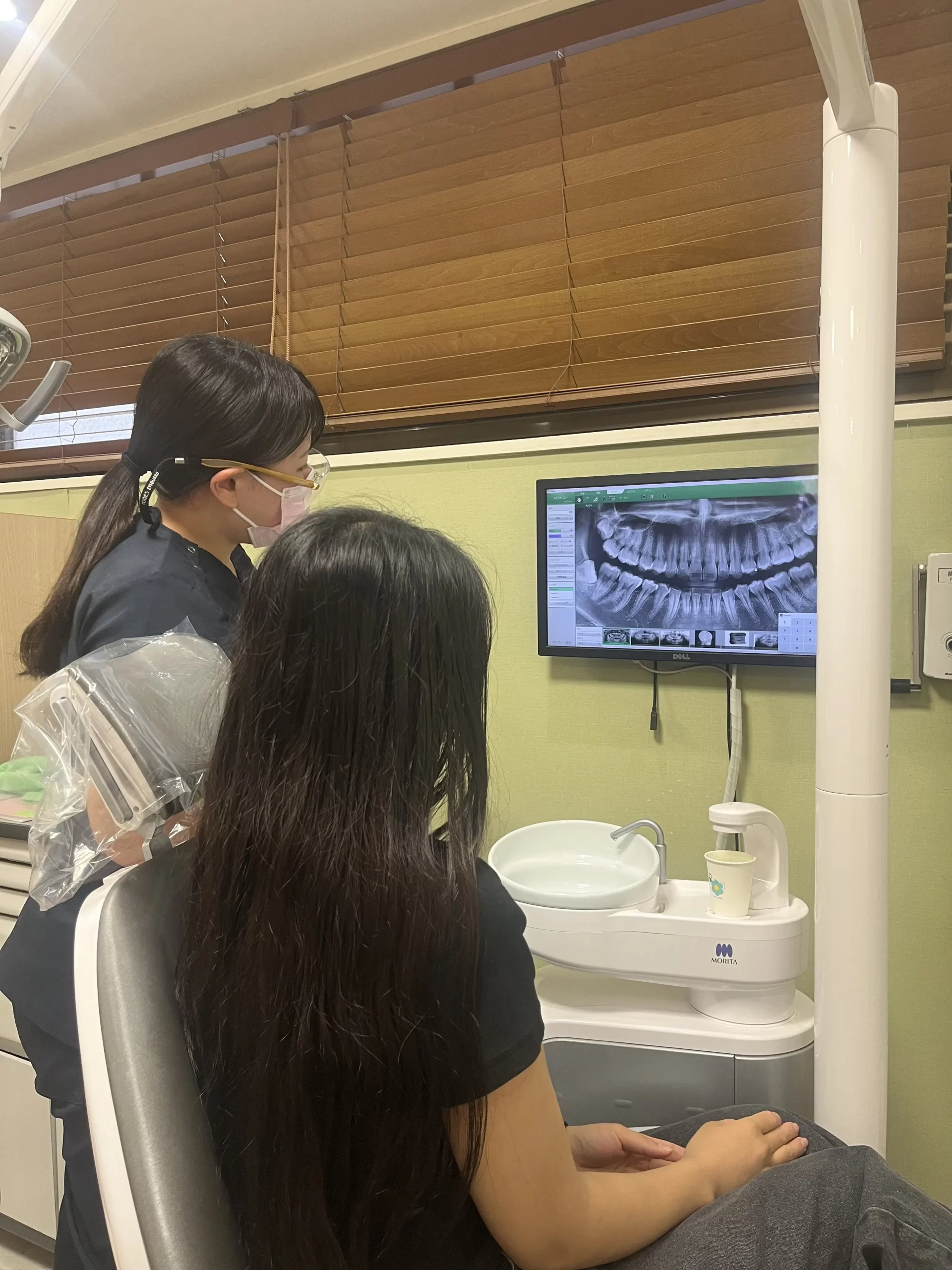 親知らず腫れた　よくある質問　登戸グリーン歯科