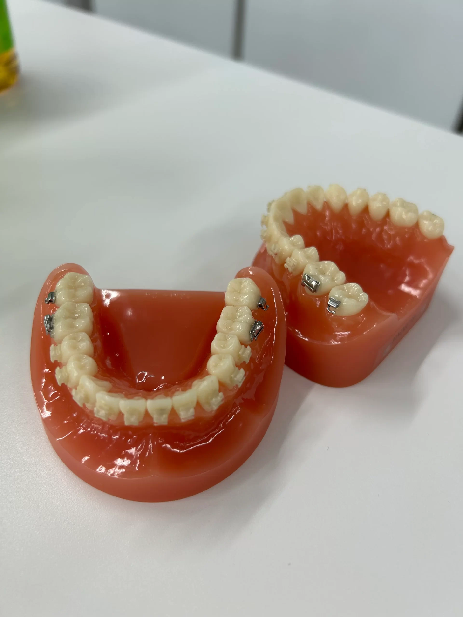 ゴムメタルワイヤー 非抜歯矯正 登戸歯医者